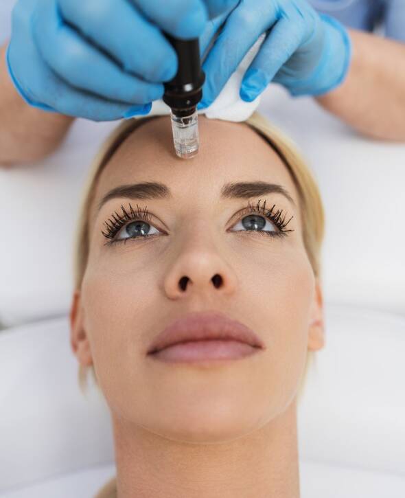 Microneedling in Bad Salzuflen